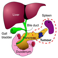 pancreas_ops_diagram-2